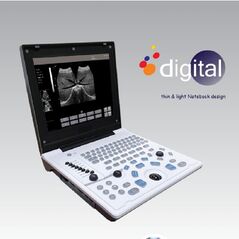 Laptop Ultrasound machine, Ultrasound Machine - Trademart.pk
