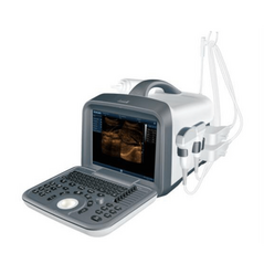 Fully Digital Ultrasound machine, Ultrasound Machine - Trademart.pk