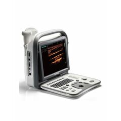 Digital Ultrasound Scanner B/W – NSL A5 Sonoscape, Ultrasound Scanner - Trademart.pk