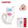 Sonolineb Pregnancy Doppler Fetal Heart Detect Unborn Baby Heartbeat Monitor, Fetal Doppler - Trademart.pk