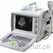Best Portable Ultrasound Machine, Ultrasound Machine - Trademart.pk